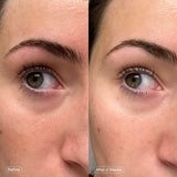 Faded Under Eye Brightening & Clearing Eye Masks - Topicals / Parches para iluminar el contorno de ojos