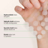 *PREORDEN:Hydrocolloid Invisible Pimple Patches - The inkey list / Parches para granitos