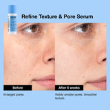 *PREORDEN: Refine AHA + BHA Texture & Pore Serum 30ml - iNNBEAUTY PROYECT / Suero para textura y poros